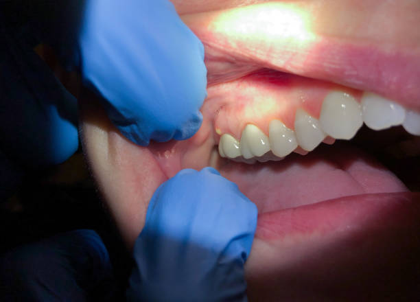 Best Emergency Dental Care for Sports Injuries in Buchanan, GA